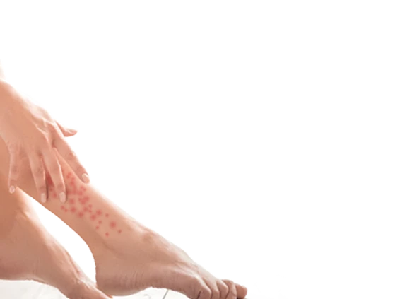 Bein mit roten Punkten